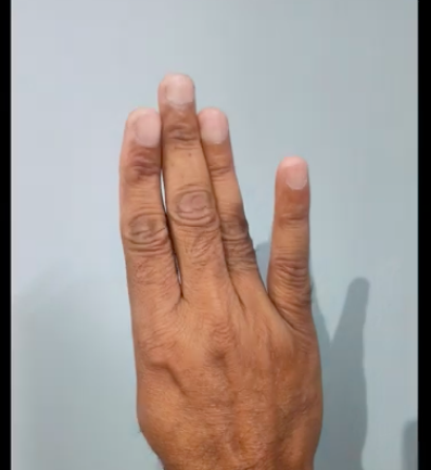 chatur mudra benefits and complete information Ayurved.online